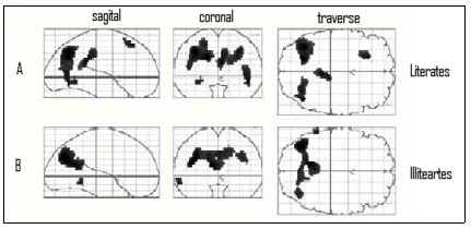 Figure 1: Example of functional brain organization differences between literates and illiterates