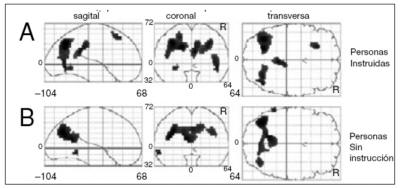 Figura 1: Ejemplo de diferencias funcionales en la organización del cerebro de personas instruidas y sin instrucción Figura 1: Ejemplo de diferencias funcionales en la organización del cerebro de personas instruidas y sin instrucción